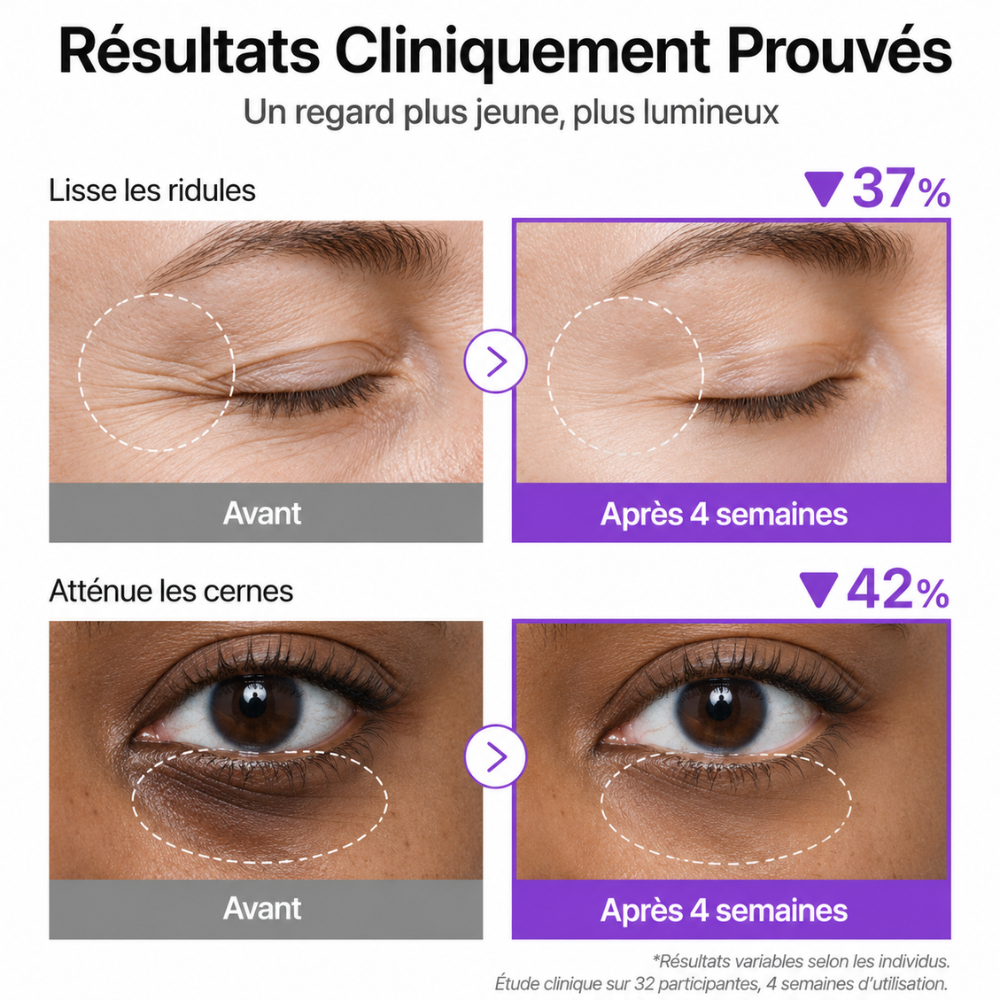 Sérum Rétinol Contour des Yeux